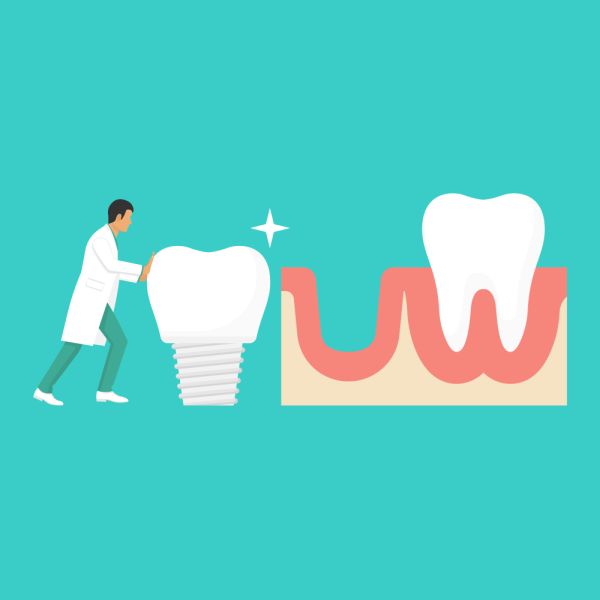 Dental Restorations: What To Do If You Knock Out A Tooth