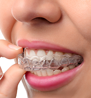 Clear Aligners - Almost Invisible Braces Spokane, WA